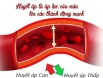 Sau tuổi 50, nam giới mỡ máu cao nên chạy bộ hay tập sức mạnh?